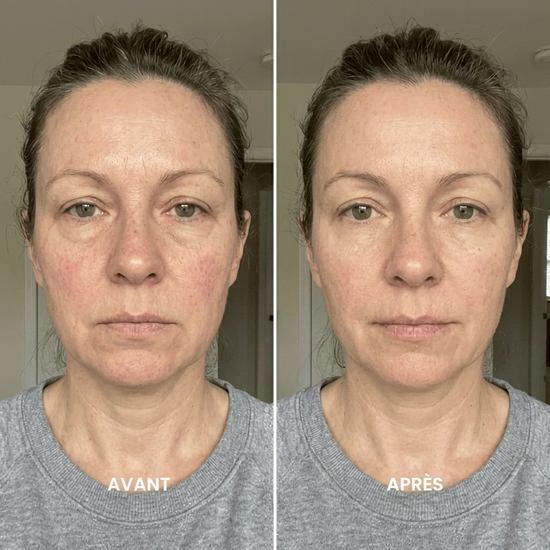 LUXEO™- Brosse de Drainage Lymphatique Visage